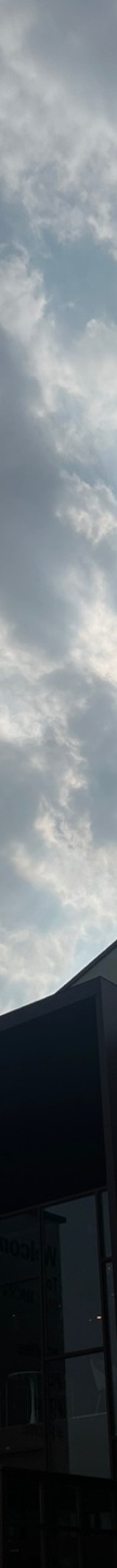 인중축소후기 인중 길이 고민 해소 관련 이미지 24