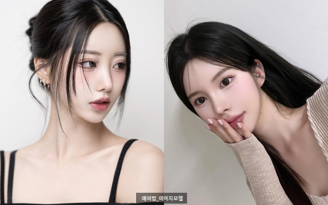 짝눈재수술, 눈매교정 같이 해야할까 관련 이미지 9