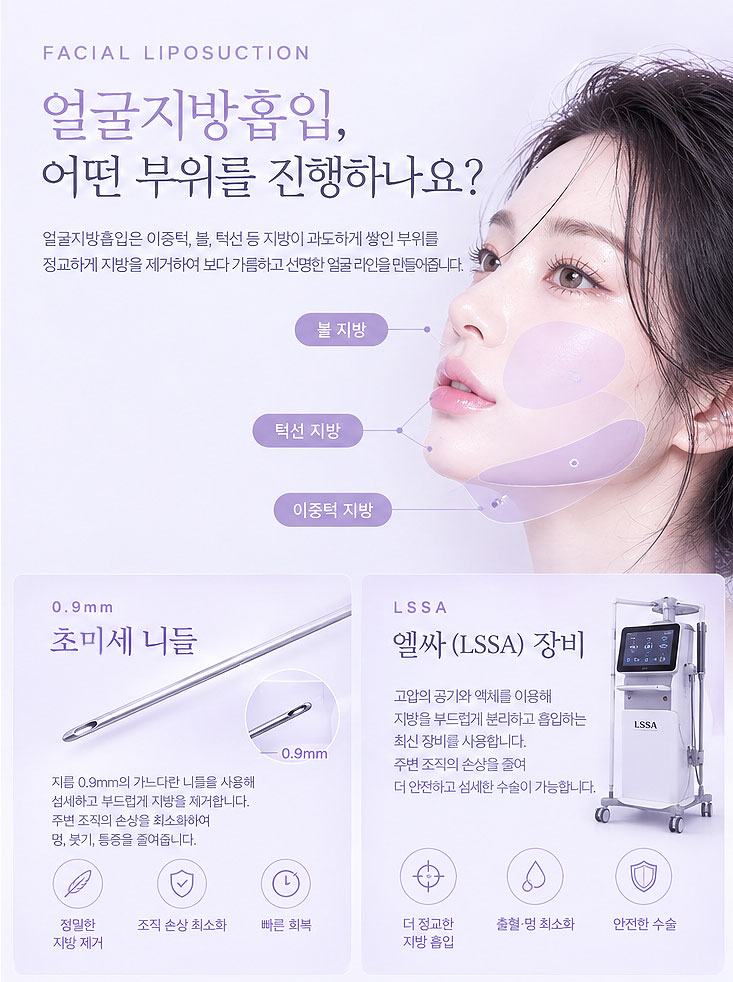 얼굴지방흡입, 매끄러운 얼굴형라인 찾기 관련 이미지 3