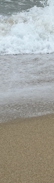 인중코성형후기 내 코에 맞는 핏한 수술 관련 이미지 25