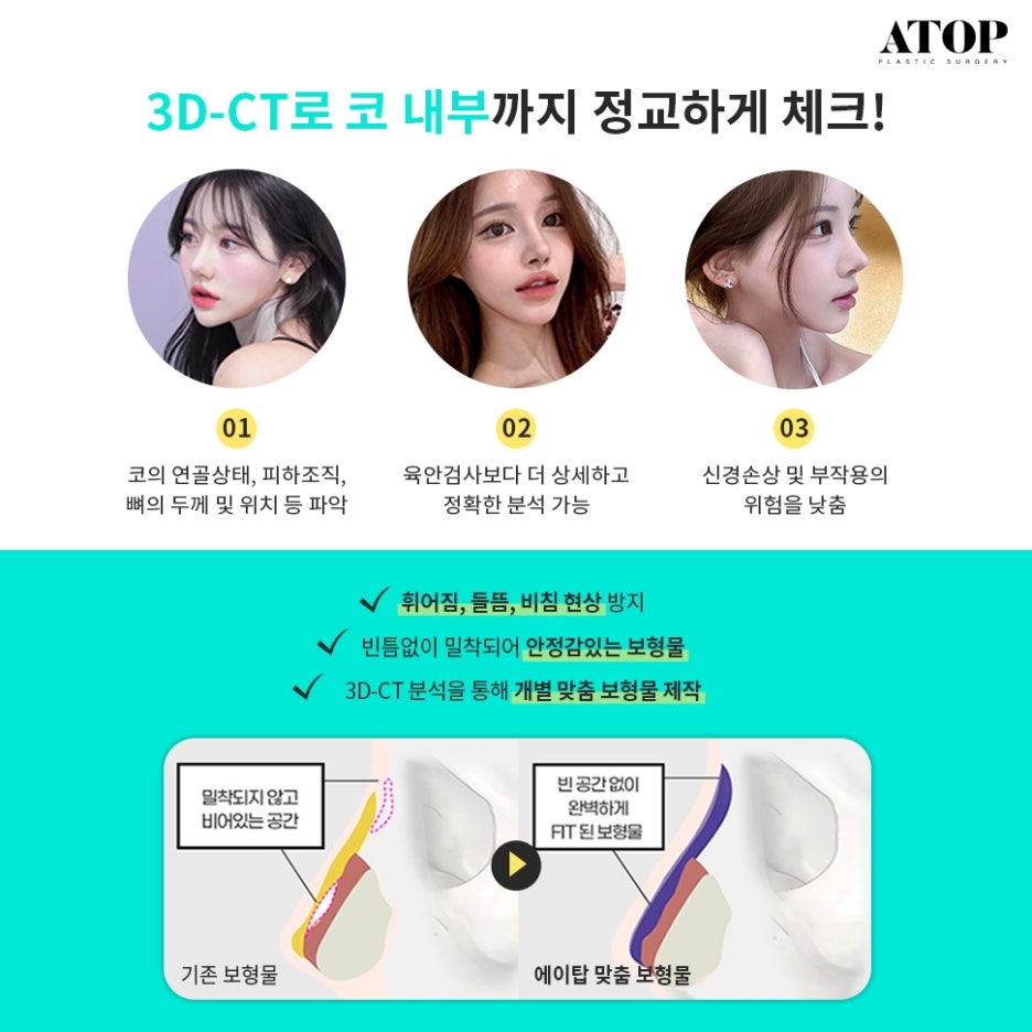 매부리코성형후기 차이나는 이유 관련 이미지 6