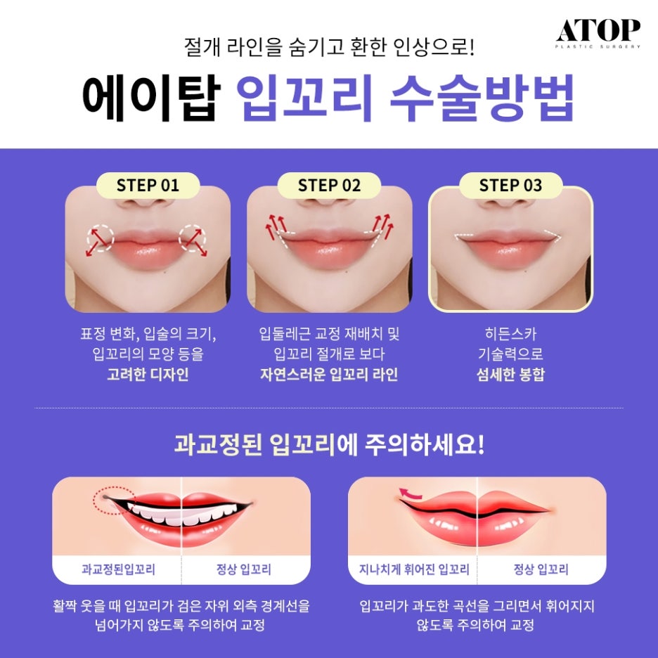 인중축소재수술 비율에 맞는 디자인으로 관련 이미지 4