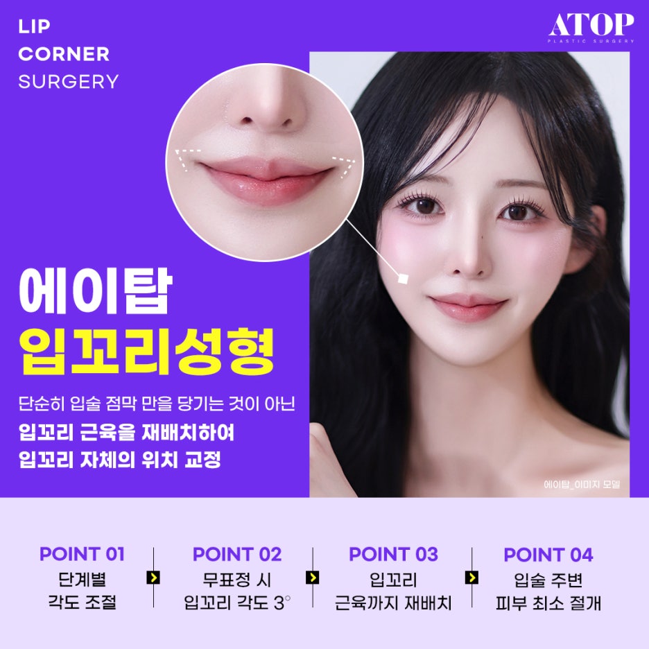 입꼬리수술내돈내산 위치 자체가 교정돼 더 자연스러워 관련 이미지 2