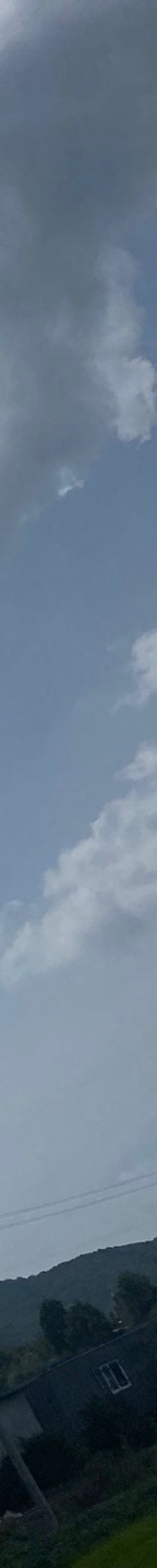 쌍수재수술가격 자연스러운 눈으로 관련 이미지 18