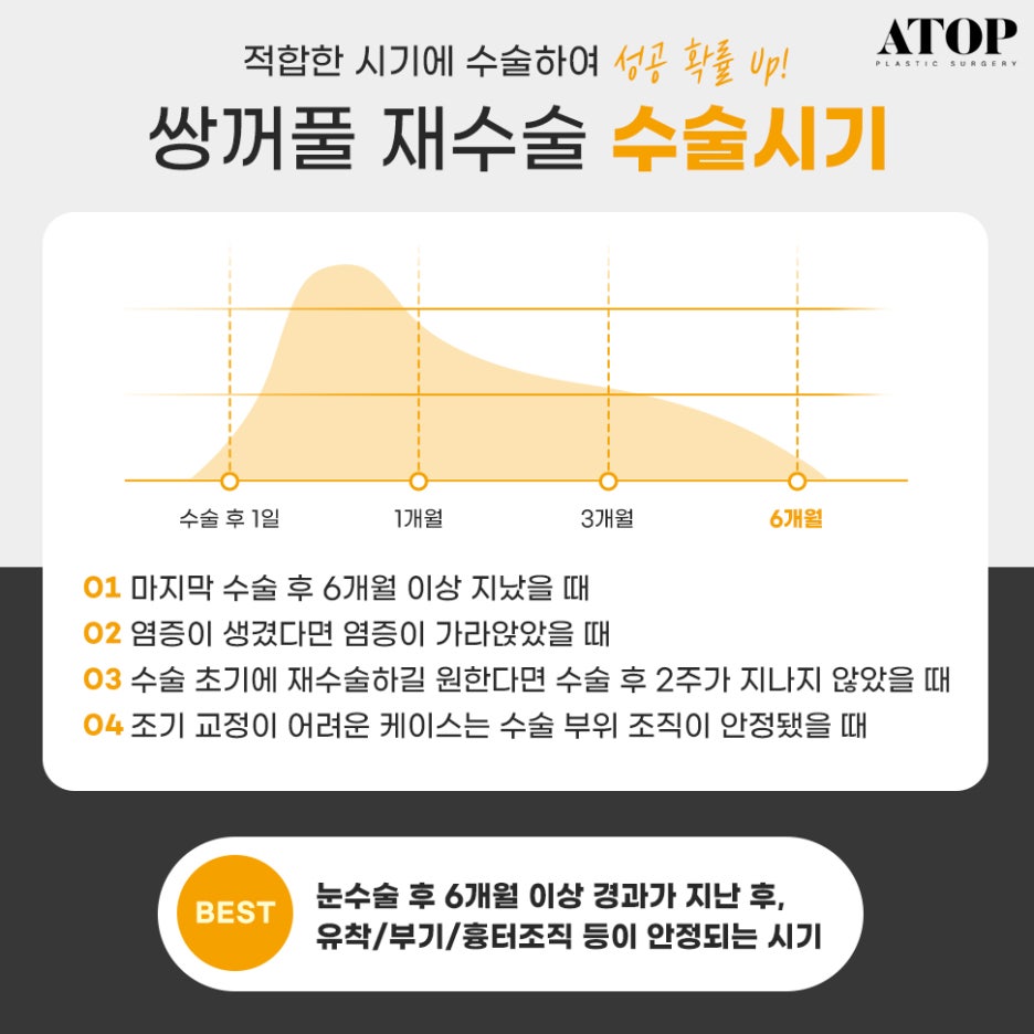눈재수술병원 내 눈에 집중한 맞춤 수술 관련 이미지 4