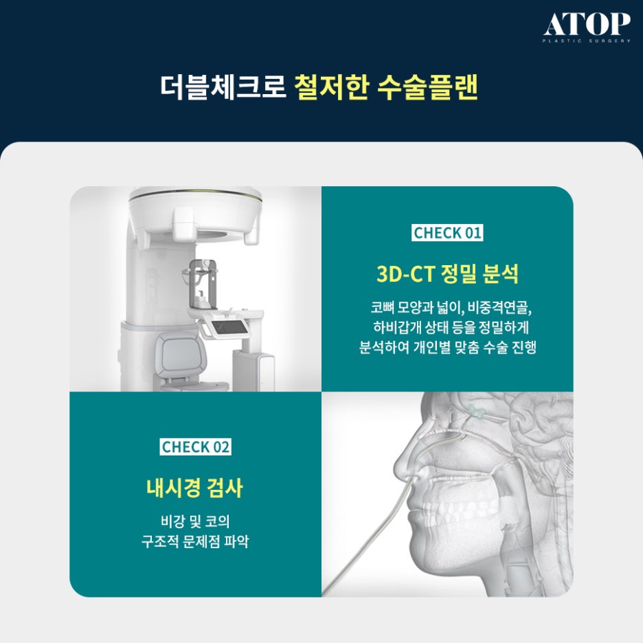 코재수술병원 변형된 코 원래 모습대로 관련 이미지 5
