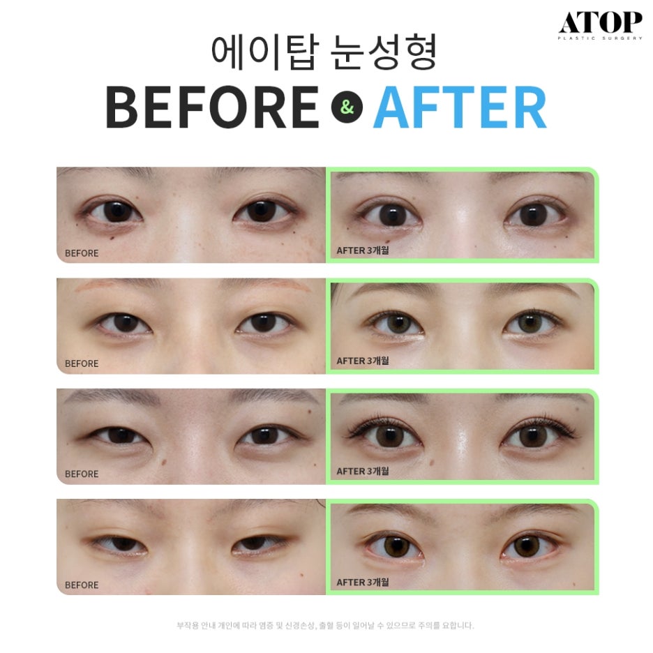 세미아웃라인자연유착 화려함과 자연스러움을 함께 관련 이미지 7
