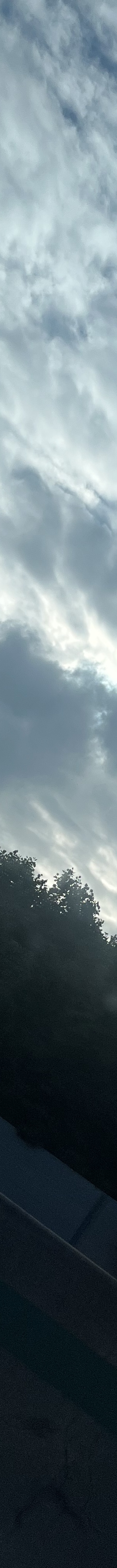 짝눈재수술, 눈매교정 같이 해야할까 관련 이미지 22
