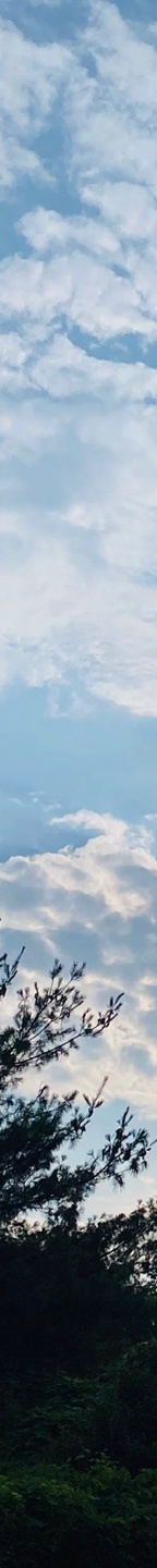 중년눈밑지방 눈꺼풀이 계속 처진다면? 관련 이미지 20