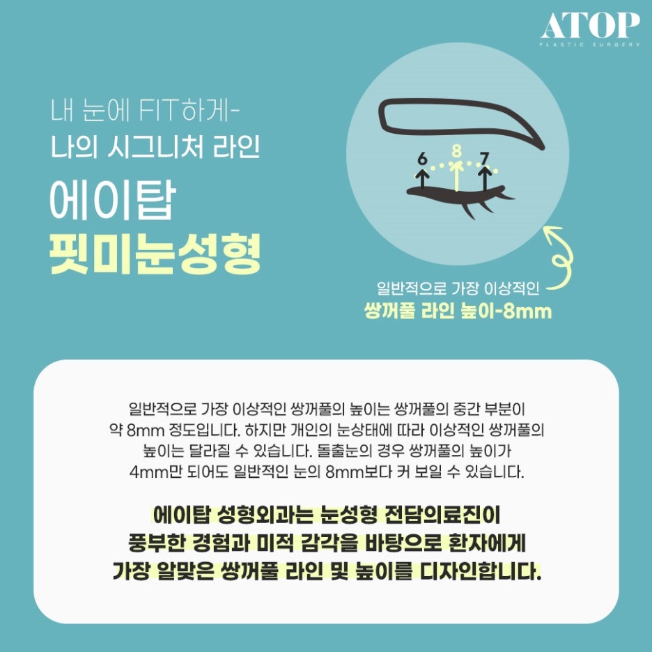 자연유착쌍수후기 인아웃라인 만들기 관련 이미지 2