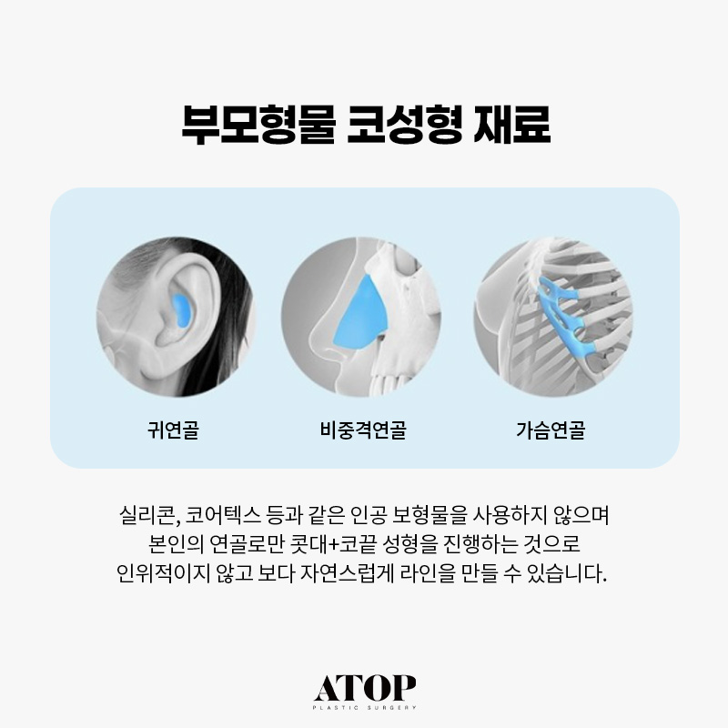 무보형물 코성형 만족도가 떨어질까? 관련 이미지 4