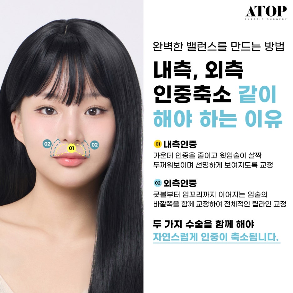 인중축소수술후기 최대 줄일 수 있는 길이는? 관련 이미지 6