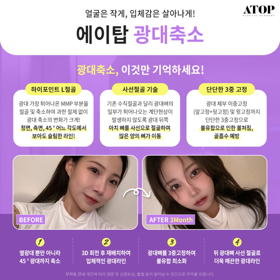 윤곽3종후기 진짜 만족하는 이유 관련 이미지 3