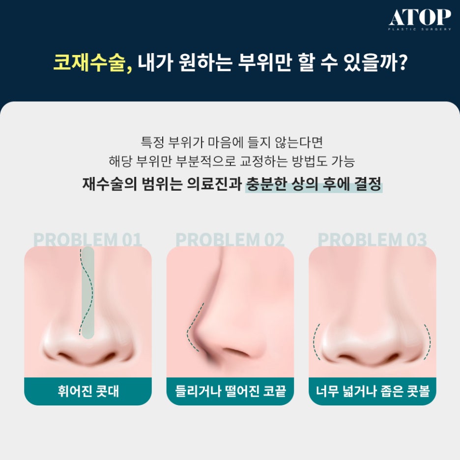 코재수술병원 변형된 코 원래 모습대로 관련 이미지 3