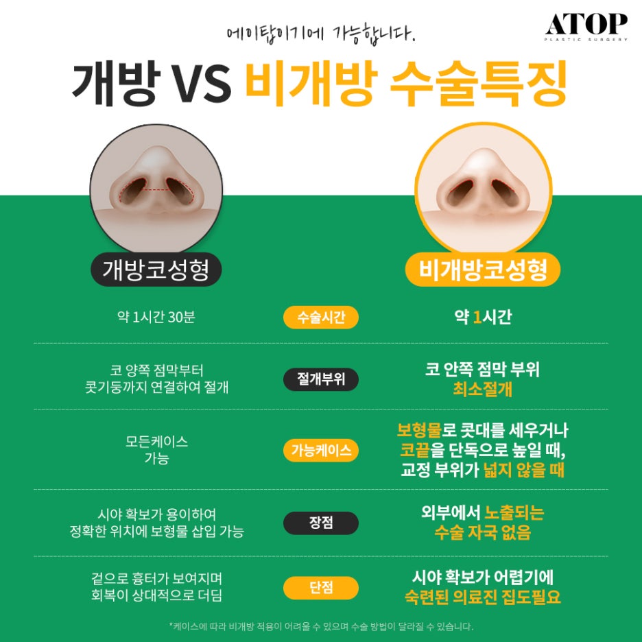 비개방코수술 드러나지 않는 절개선으로 자연스러움 up 관련 이미지 3