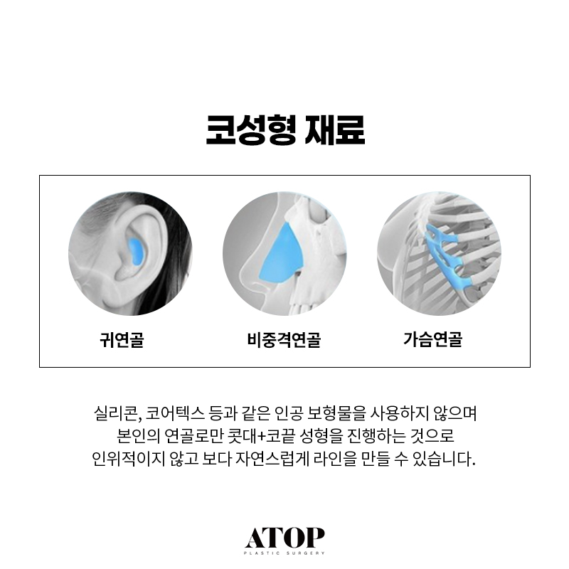 비중격연골 코끝수술 장단점, 의료진의 연골 선택 기준 관련 이미지 3