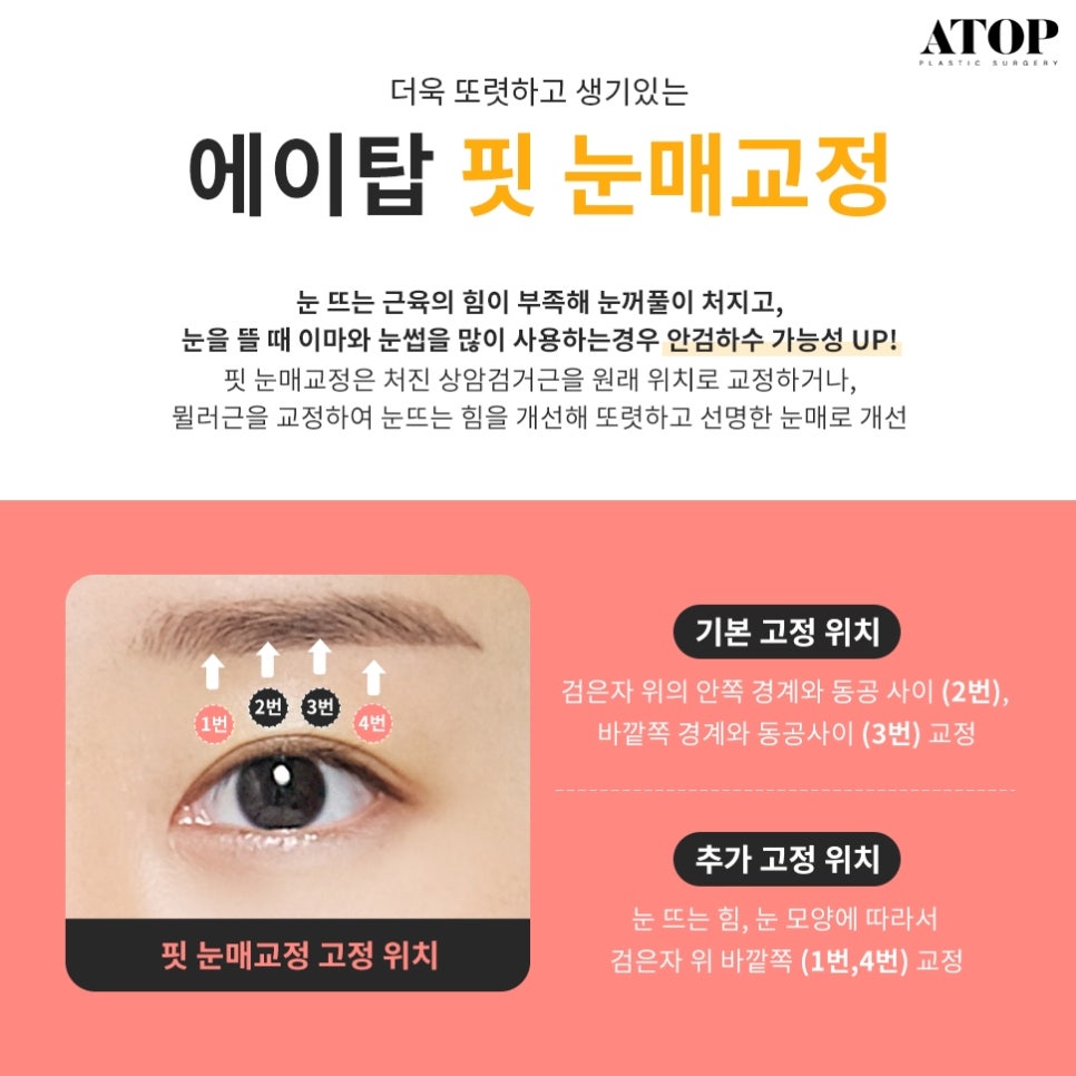 자연유착쌍수후기 핏한 쌍꺼풀과 트임으로 자연스럽게 관련 이미지 5