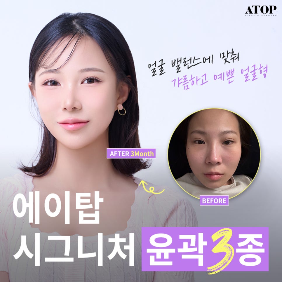 윤곽3종내돈내산 달라진 비포애프터에 만족해 관련 이미지 1