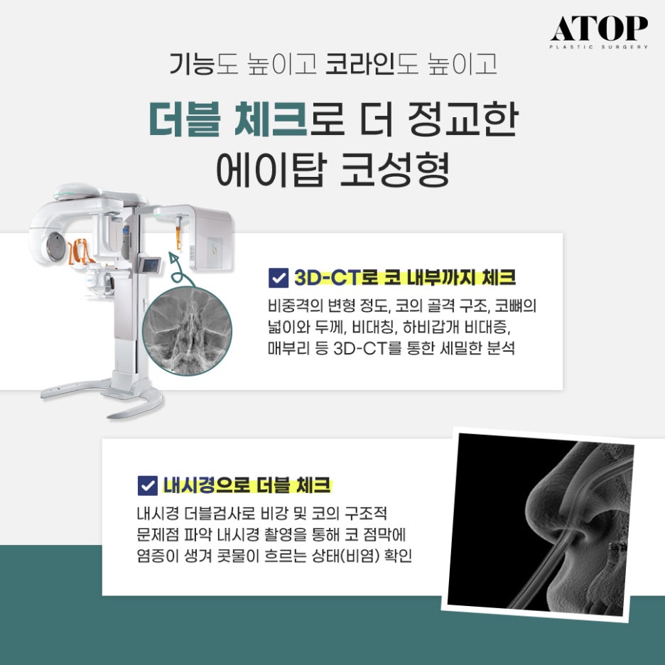 Male Nose Surgery Review: A Natural Line That Doesn’t Look Artificial image 5