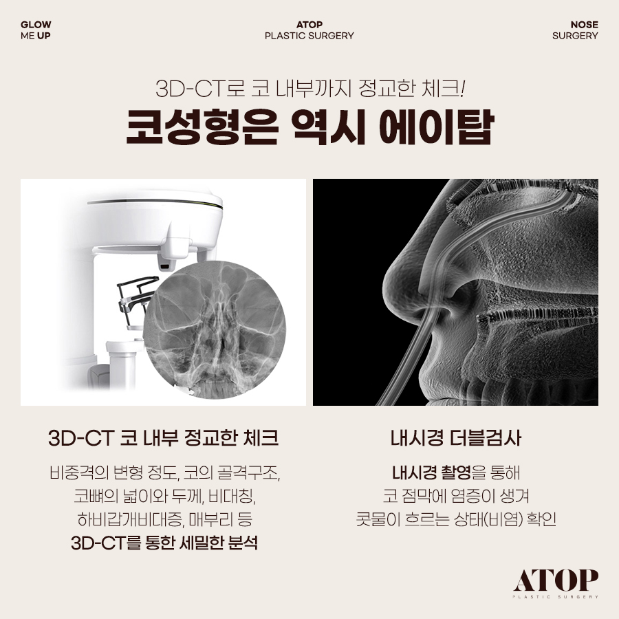 기능코성형, 코 모양은 물론 숨길을 함께 고려해야 하는 이유 관련 이미지 4