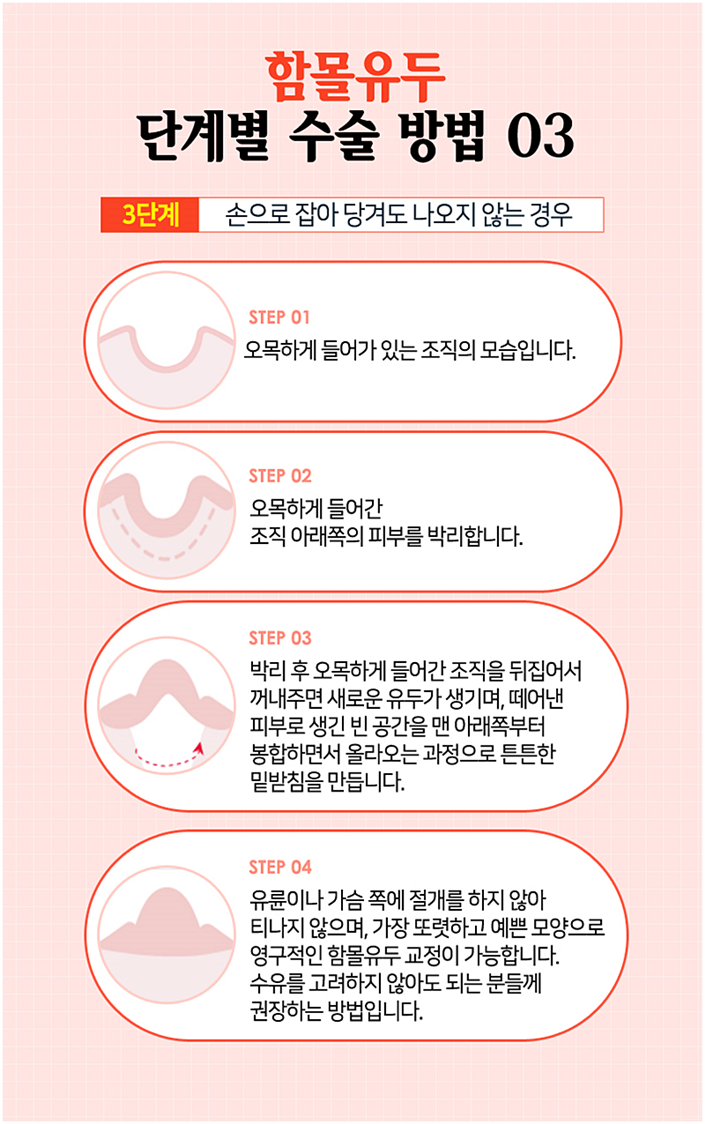 유두성형 더 당당해질 수 있지 관련 이미지 7