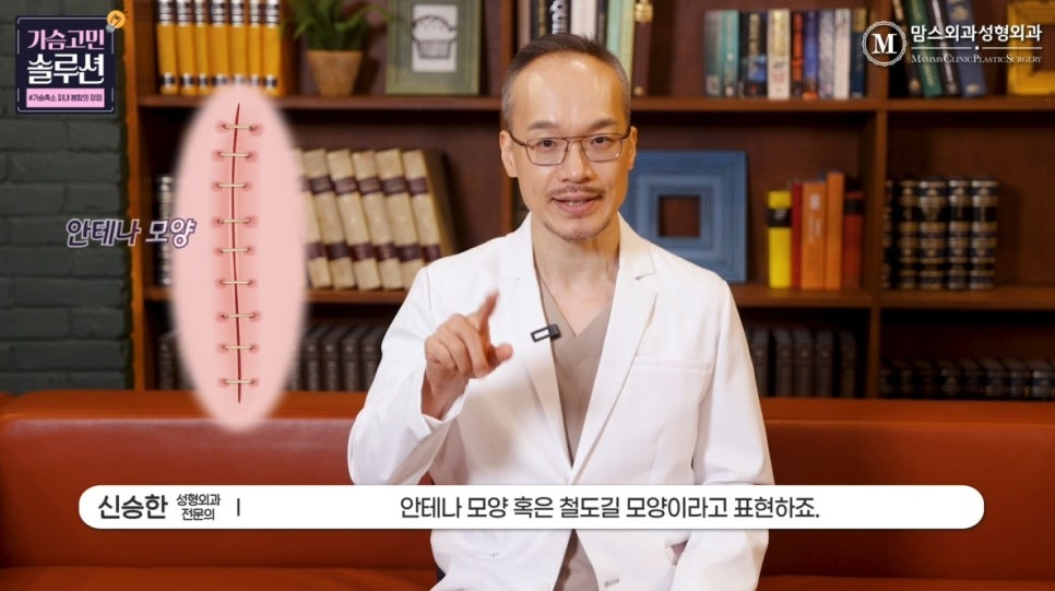 가슴축소 피내 봉합의 장점과 단점은? 관련 이미지 5