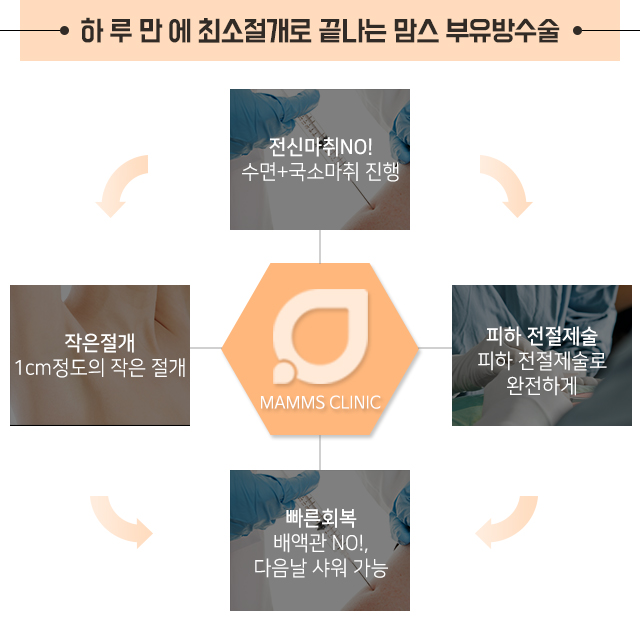 부유방제거수술 특별함을 관련 이미지 4