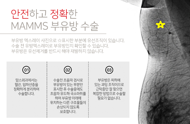부유방운동 아무리해도안빠진다면 관련 이미지 3