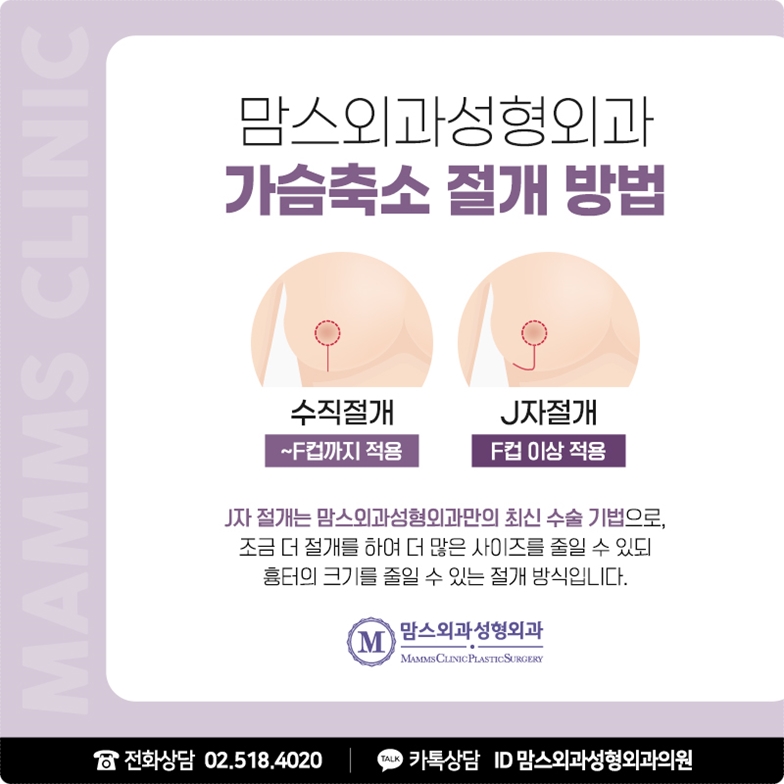 가슴축소술후기, 가볍게 관련 이미지 6