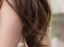 Areolar Surgery, Done Right in Just One Procedure! Toward Balanced Beauty image 20