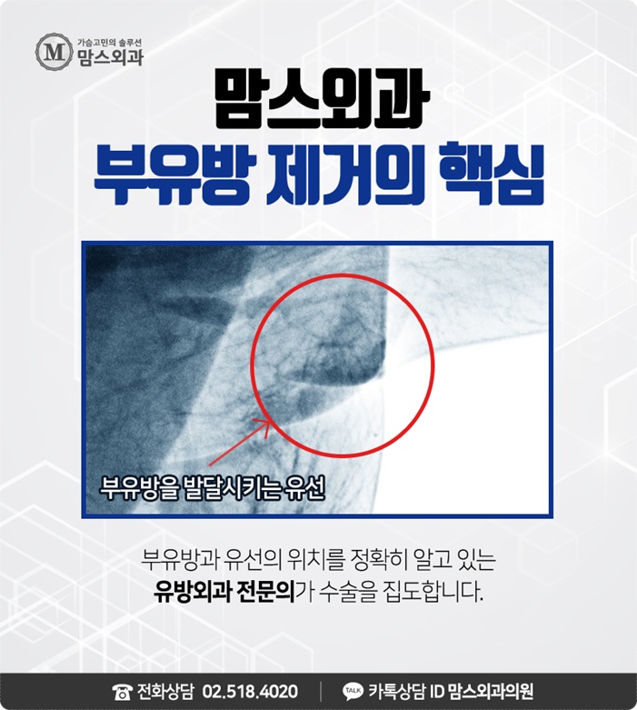 부유방 수술 후기 근심을 덜자 관련 이미지 9