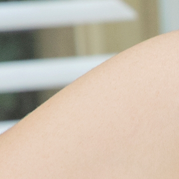Could the protruding underarm bulge be an accessory breast instead of fat? image 17