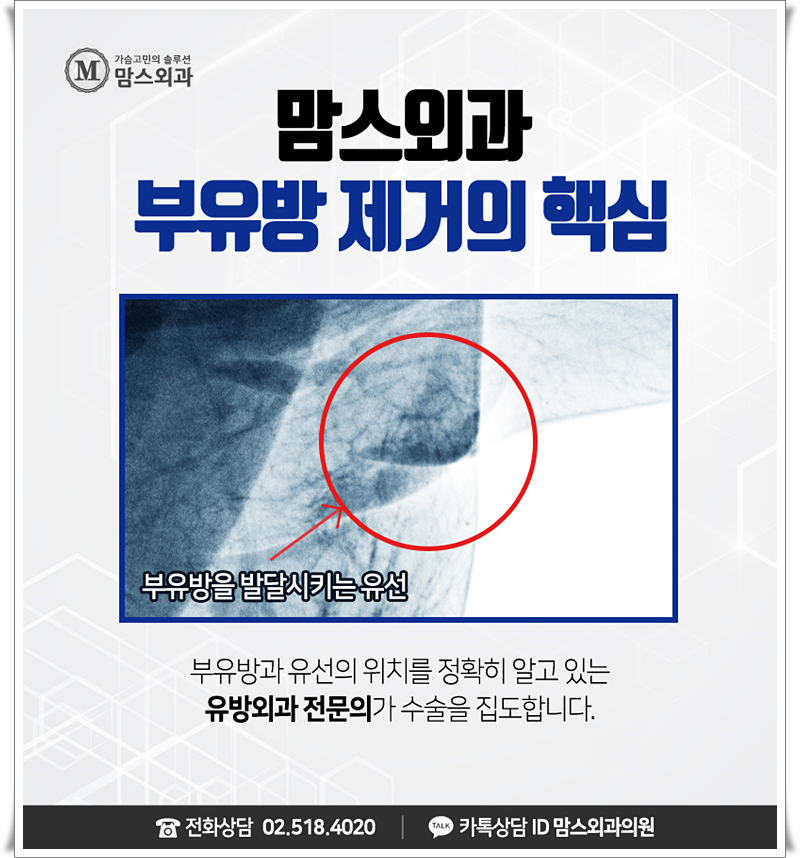 부유방살빼기 가능할까요? 관련 이미지 7
