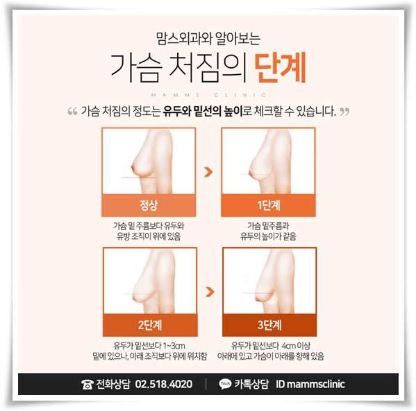 처진가슴수술후기 만족도 높이려면 관련 이미지 4