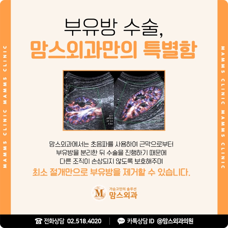 가슴 멍울 도대체 어떤 것일까? 관련 이미지 9