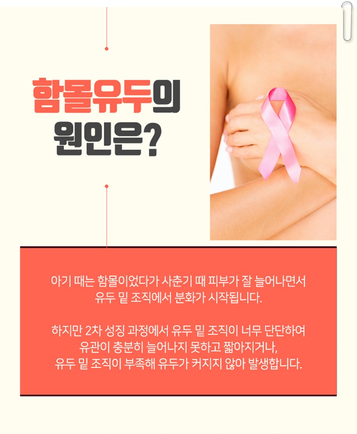 함몰유두교정 답을 찾으세요? 관련 이미지 3