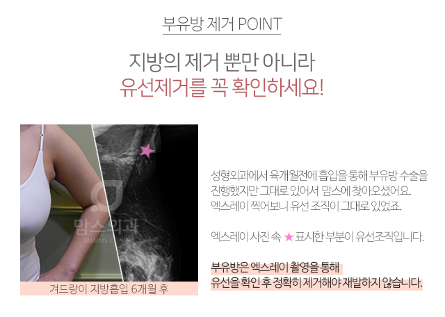 겨드랑이멍울 잡히시나요? 관련 이미지 4
