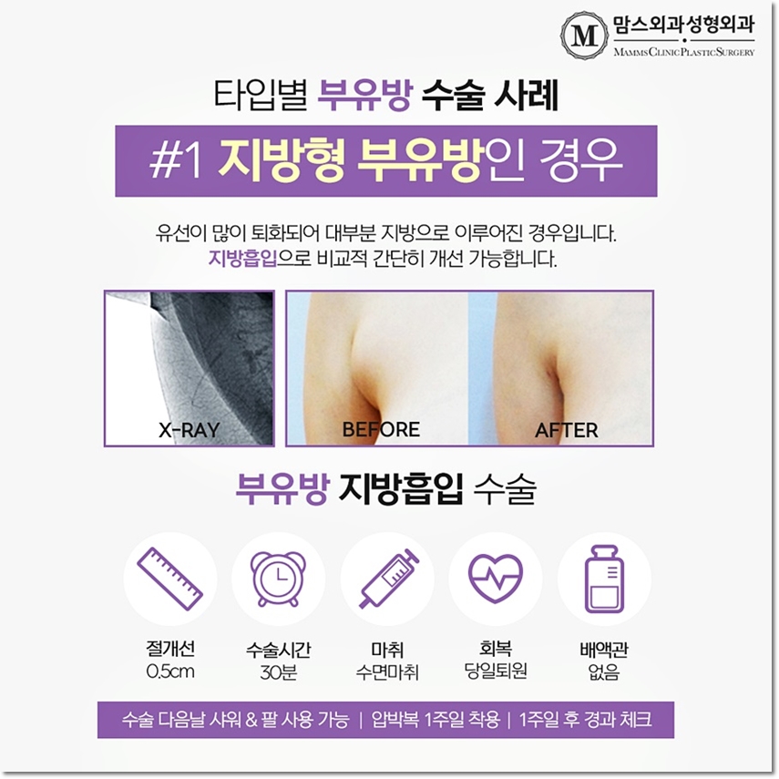 Why Does My Armpit Hurt? image 5
