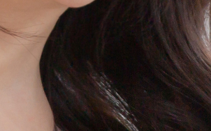Why Should You Choose Accessory Breast Surgery Instead of Accessory Breast Injections? image 18
