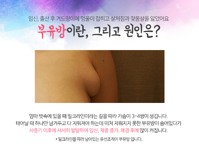 임신부유방 왜이런거죠 관련 이미지 3