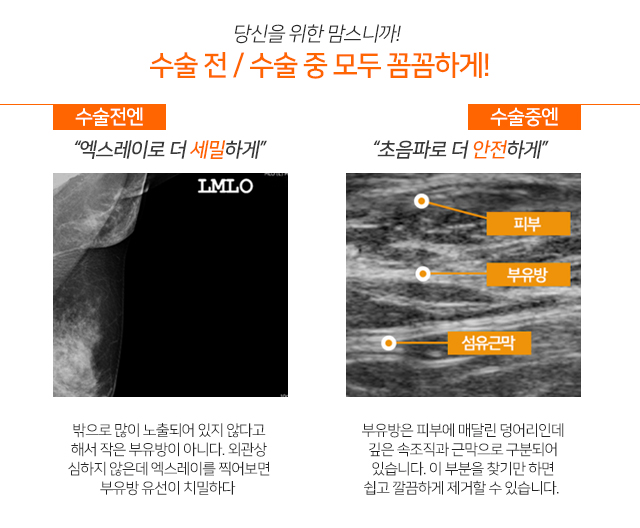 겨드랑이멍울 걱정된다면 관련 이미지 3
