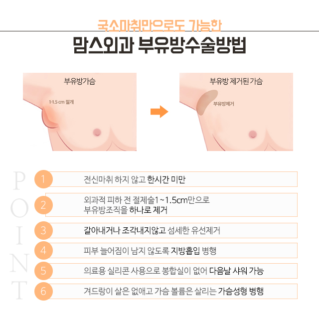 부유방제거수술 특별함을 관련 이미지 3