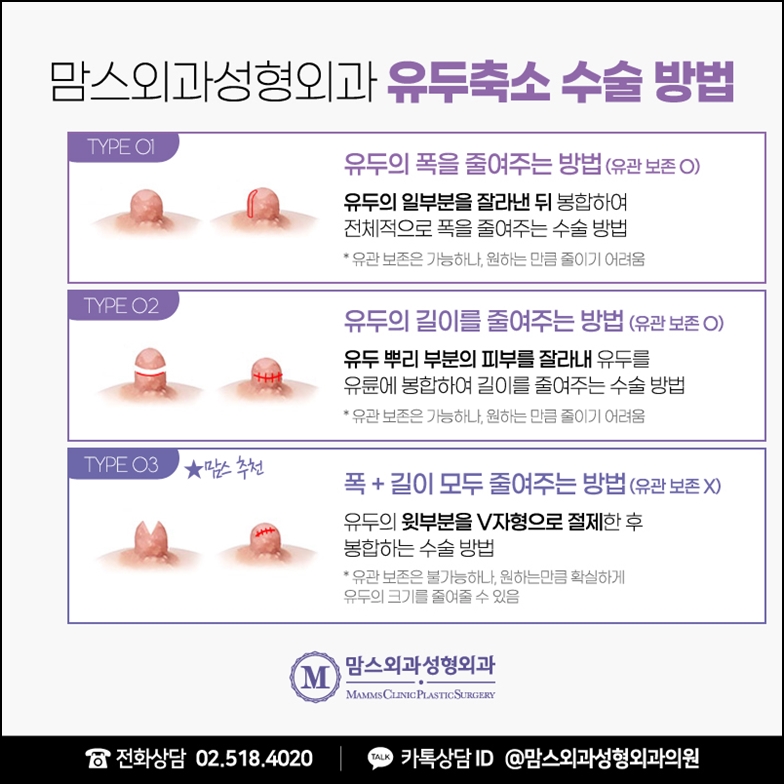 유두축소수술비용 절약하고 싶다고? 관련 이미지 7
