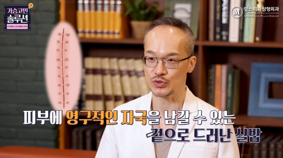 가슴축소 피내 봉합의 장점과 단점은? 관련 이미지 6