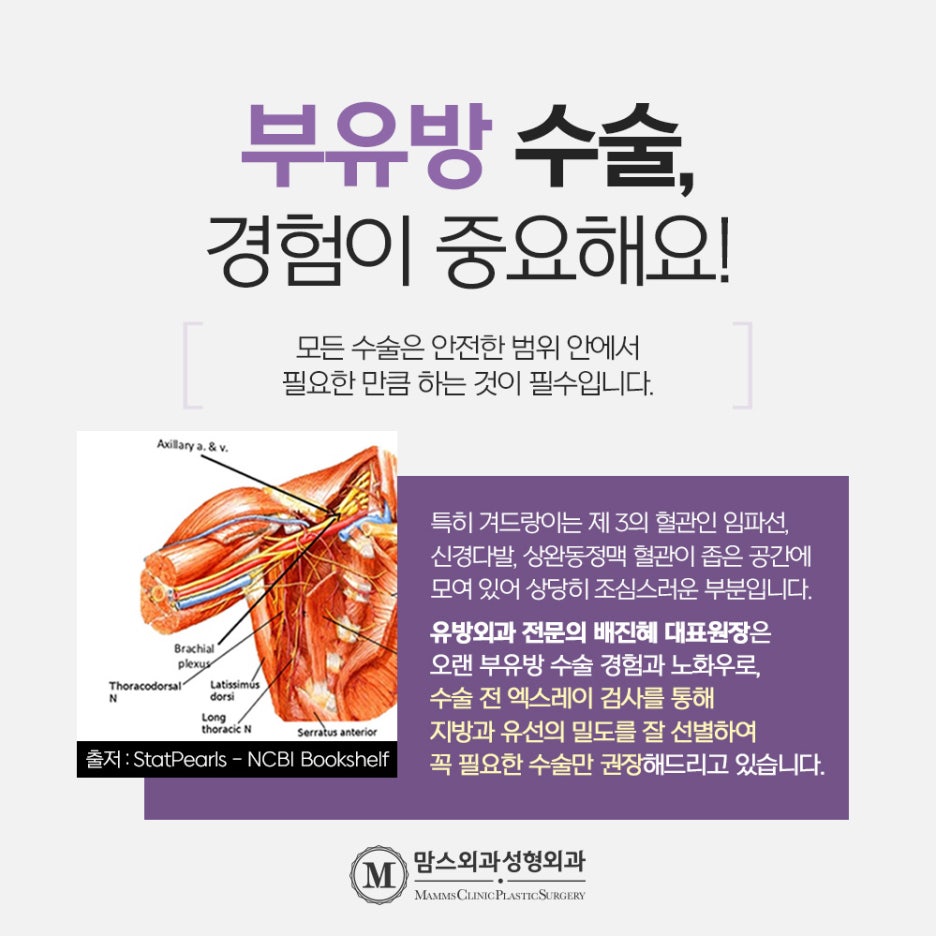 Will an Accessory Breast Injection Improve It? Click If You’re Curious image 5