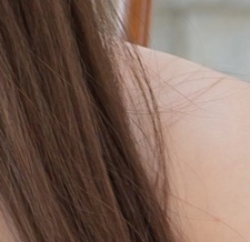 부유방제거수술 생각을 다지고 관련 이미지 21