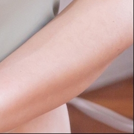 Breast Revision Surgery: What Should You Consider? image 26