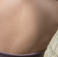 Breast Hypertrophy: Reducing Heavy Volume and Creating a Smoother Line! Is It Really Possible? image 25