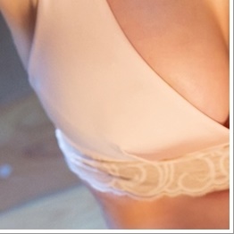 When Is Axillary Breast Tissue Liposuction Possible? image 24
