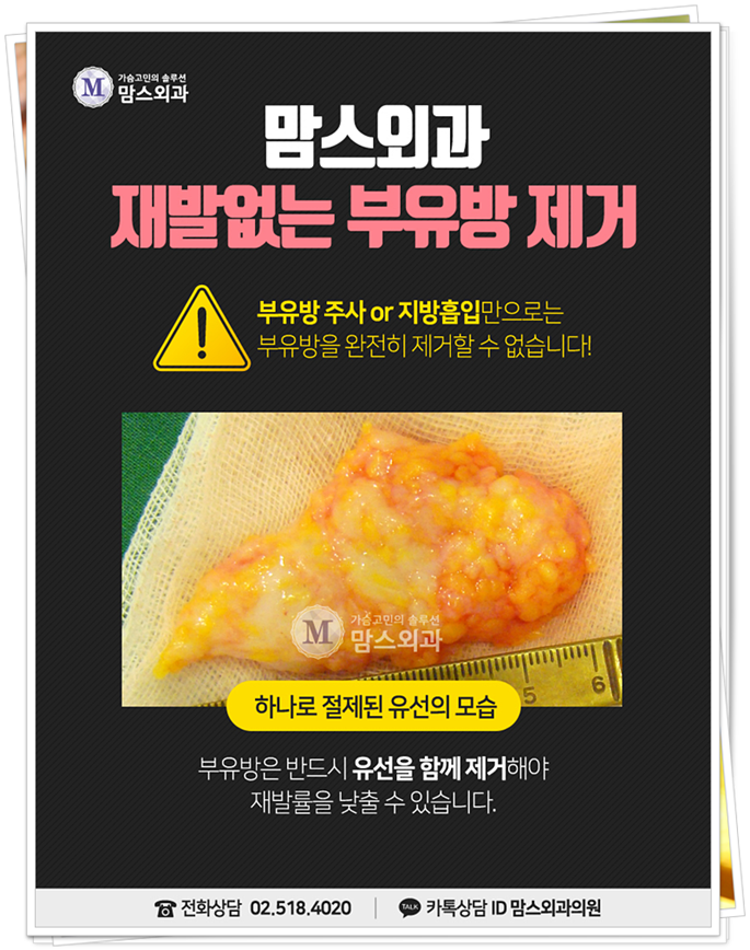 겨드랑이멍울 시선이 신경 쓰이죠 관련 이미지 6